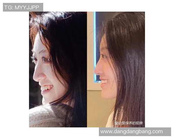 亚马尔自信分享戴牙套体验称其外观与自我形象完美契合